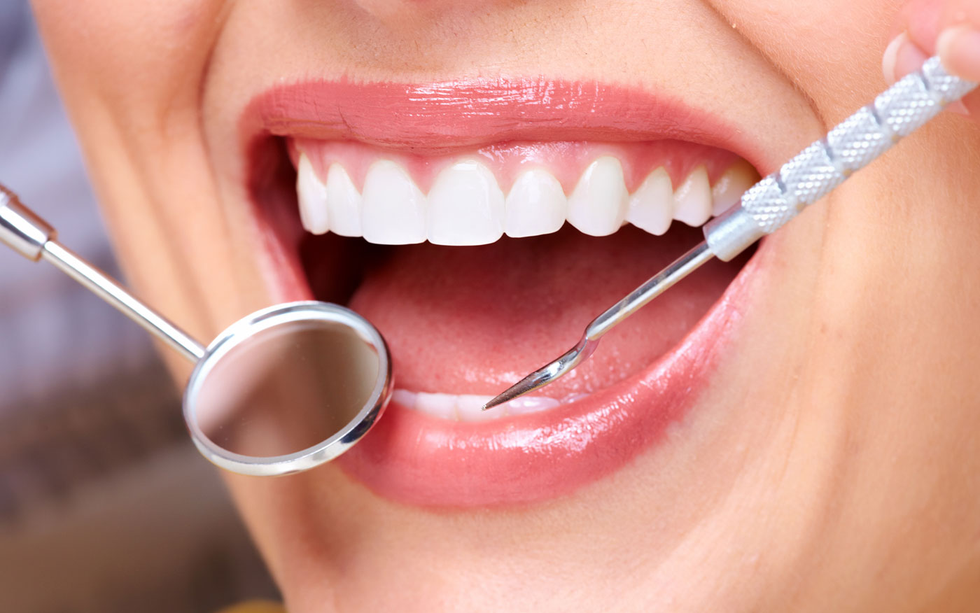 general-dentistry-in-bangalore